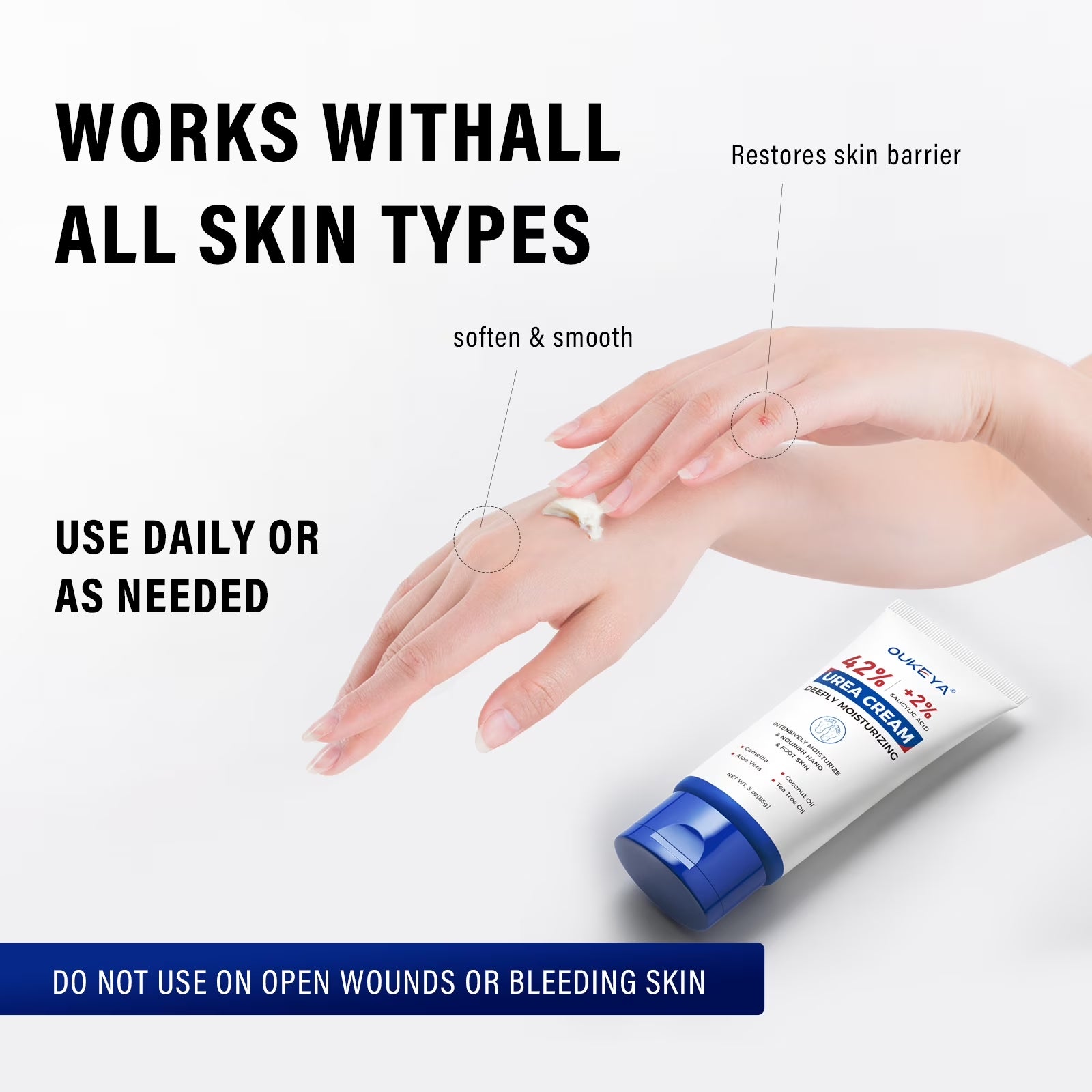 Urea Cream with Salicylic Acid Moisturizes & Exfoliates Dry Cracked Skin 3 Oz