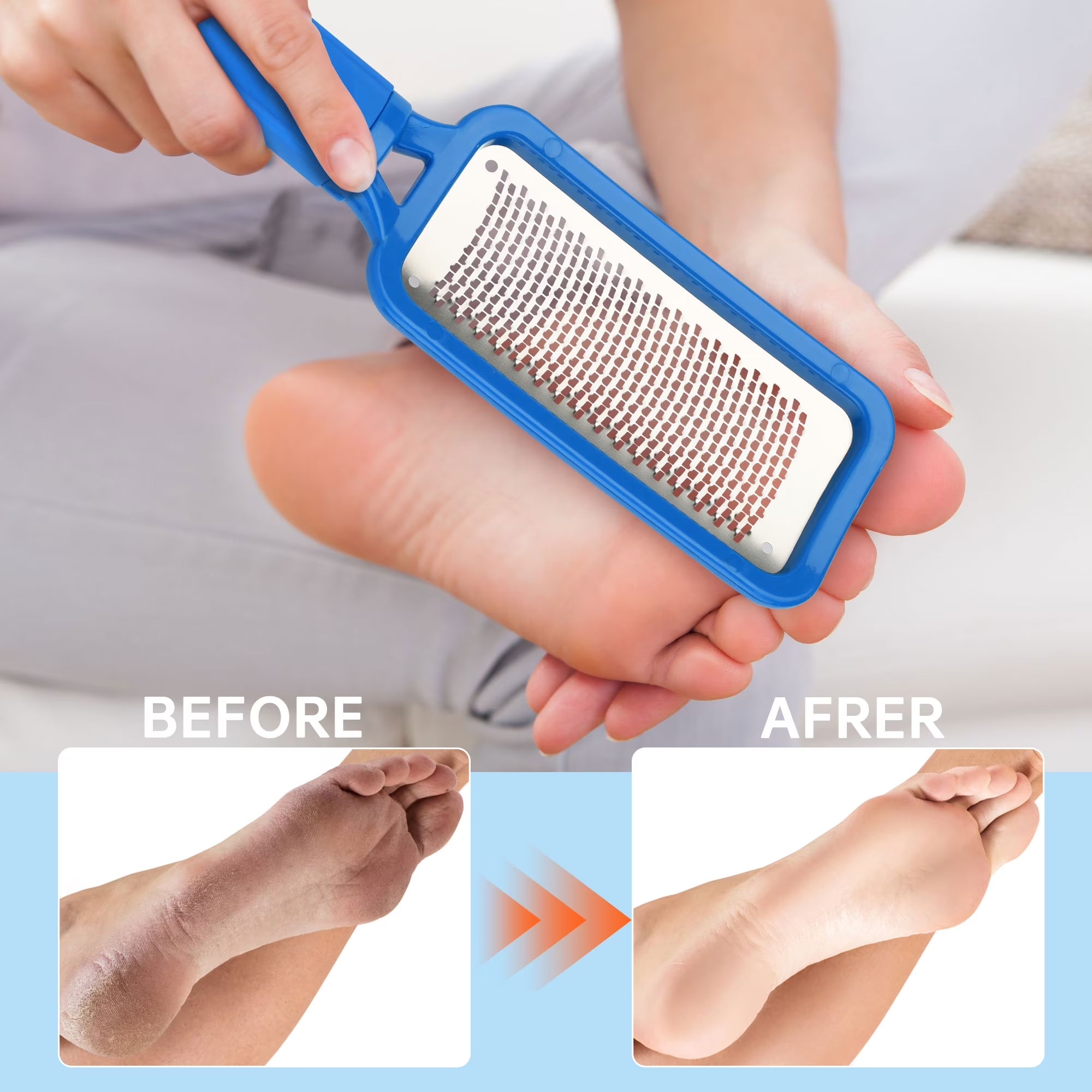 Professional Pedicure Foot File Callus Remover, Stainless Steel Heel Scraper for Dry and Wet Feet