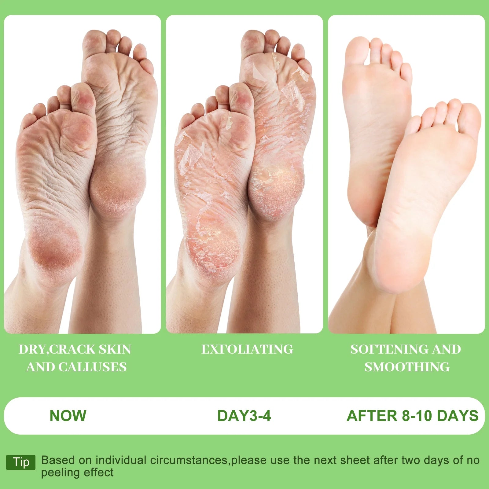 Berlaney Aloe Vera Foot Peel Mask 3 Pairs, Exfoliating Mask for Dry Cracked Feet