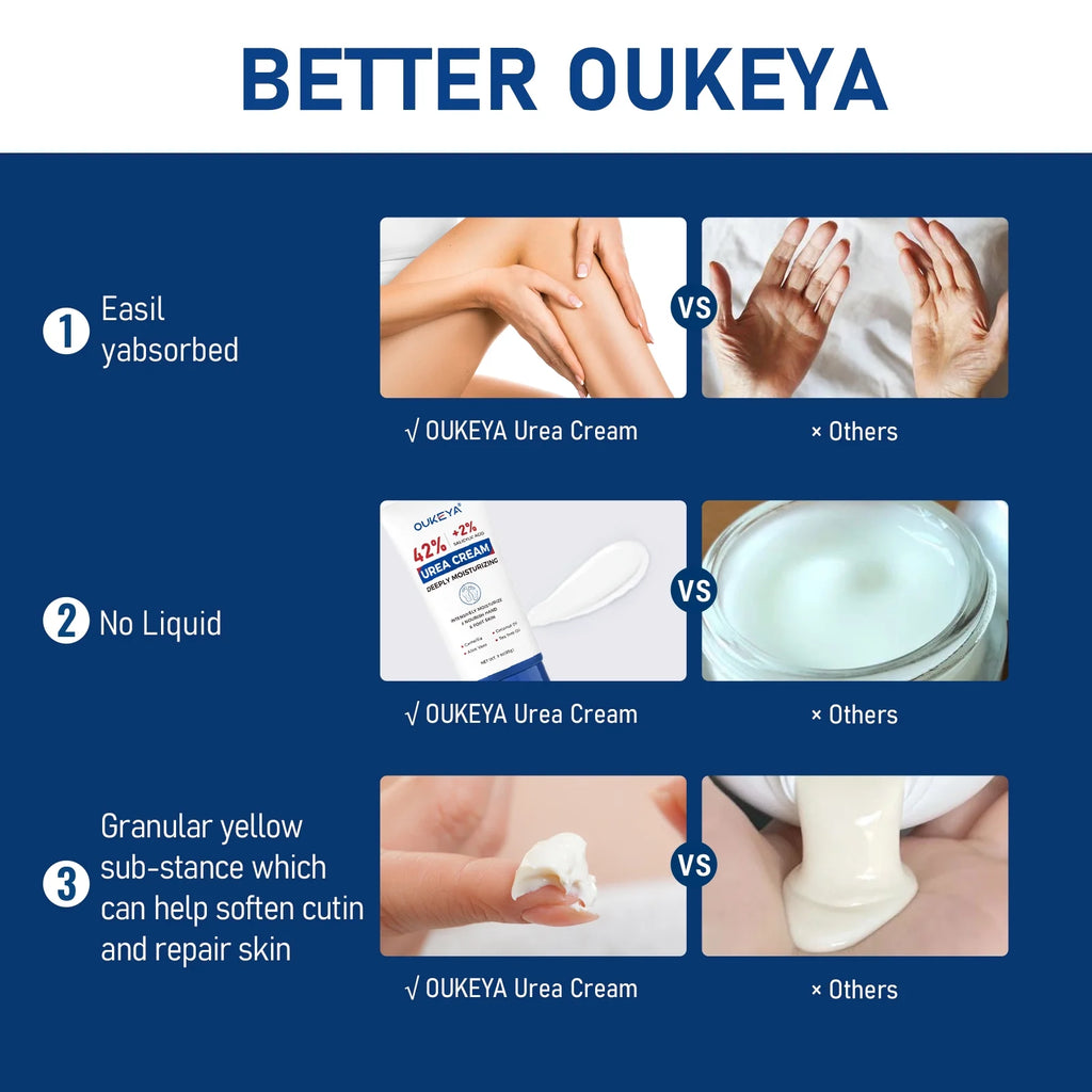 Urea Cream with Salicylic Acid Moisturizes & Exfoliates Dry Cracked Skin 3 Oz